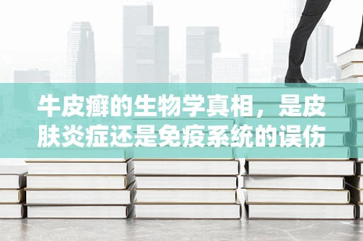 牛皮癣的生物学真相，是皮肤炎症还是免疫系统的误伤？