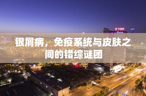 银屑病，免疫系统与皮肤之间的错综谜团