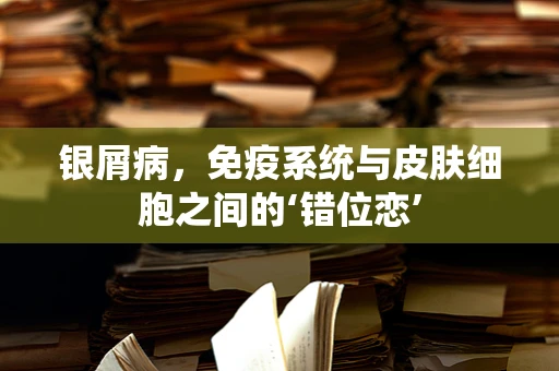 银屑病，免疫系统与皮肤细胞之间的‘错位恋’