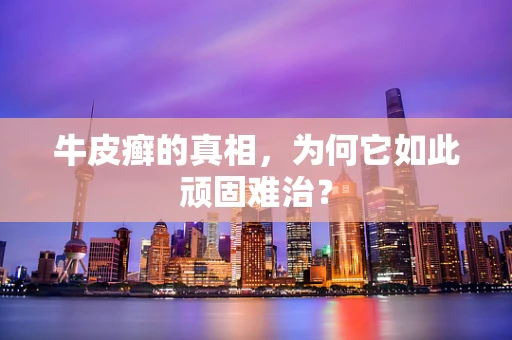 牛皮癣的真相，为何它如此顽固难治？