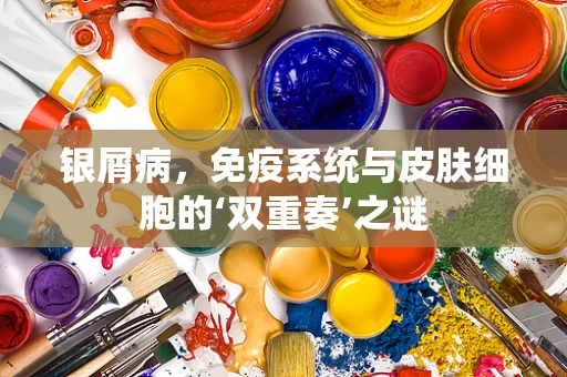 银屑病，免疫系统与皮肤细胞的‘双重奏’之谜